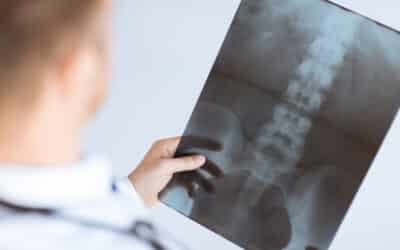 Minimally Invasive Spine Surgery: Advantages & Techniques