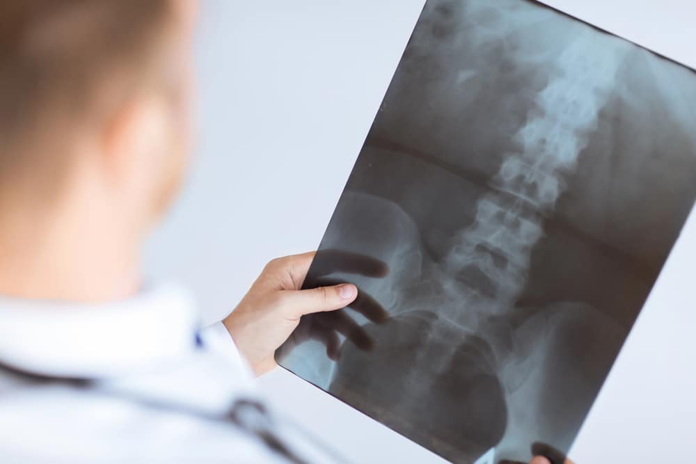 Minimally Invasive Spine Surgery: Advantages & Techniques